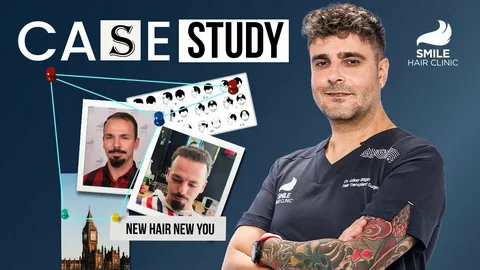 How Smile Hair Clinic Ensures Safety and Quality in Every Procedure